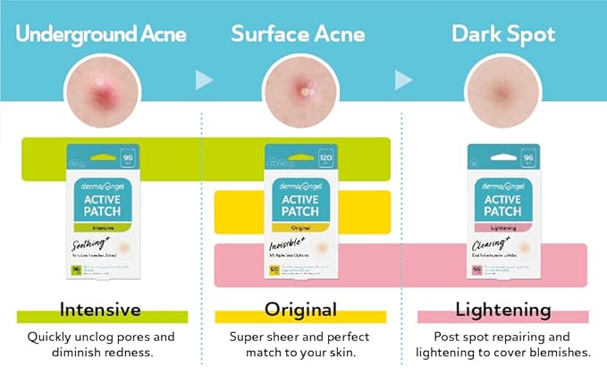 DERMA ANGEL Invisible Salicylic Acid Pimple Patches for Face - Redness Reducing Hydrocolloid Acne Patches, Clear Pimple & Zit Patches for Blind Pimples - 36 Count 2 Sizes Soothing Plus (Clear Patch)