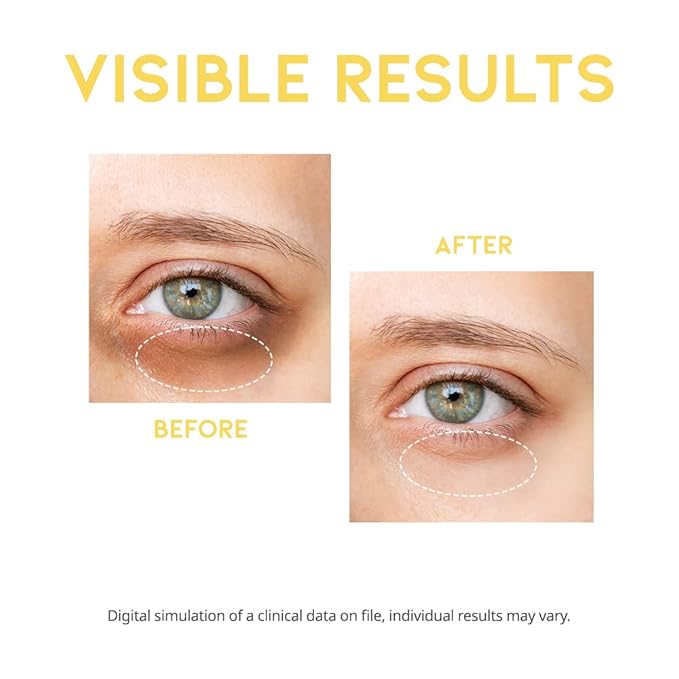 Dark circle remover eye serum,