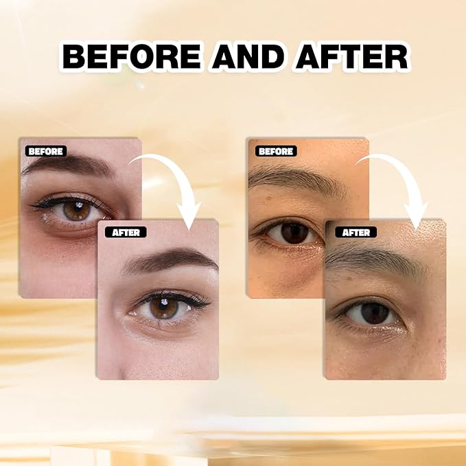 Blusheva Beauty Gold Under Eye Masks – 24 Pairs Collagen & Hydrating Gel Eye Patches for Dark Circles, Puffy Eyes, Fine Lines & Anti-Aging Skincare – Vegan, Cruelty-Free Self Care Essentials