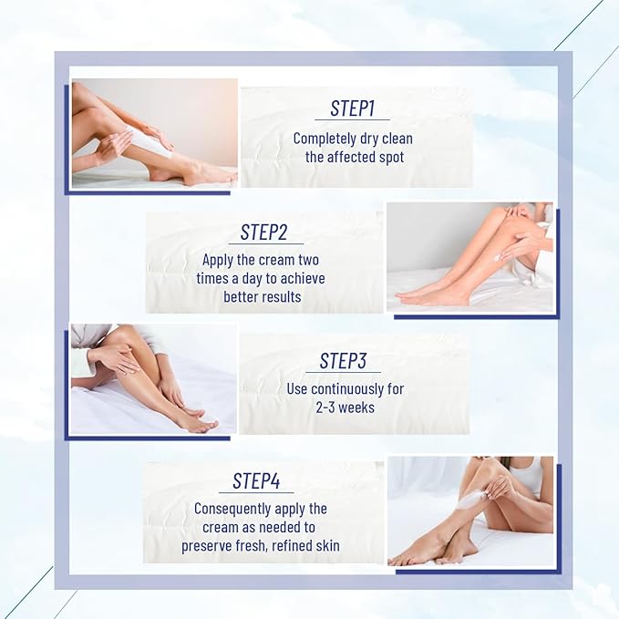 OUKEYA Urea Cream with Salicylic Acid for Dry, Rough Skin – Moisturiser for Feet, Heels, Hands & Elbows, 5.29 Oz