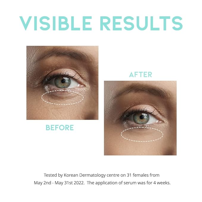 Retinol eye cream serum for