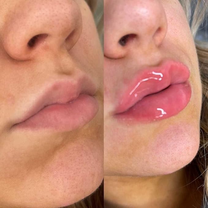 Plump It! No Needles Lip Filler Plumping