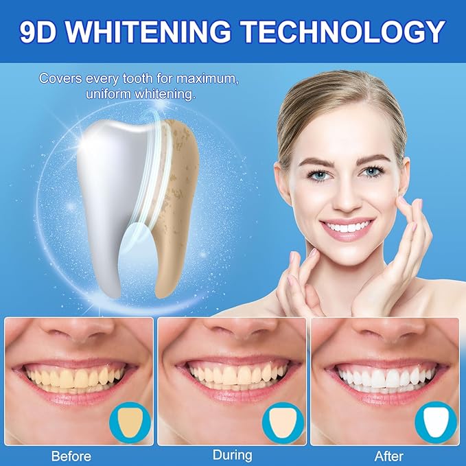 Sensitive Teeth Whitening Strips Kit - 28 Strips Whitener Safe Whitestrip,14 Treatments Sodium Hydroxide Teeth Whitener for Coffee, Wine, Tobacco, and Other Stains