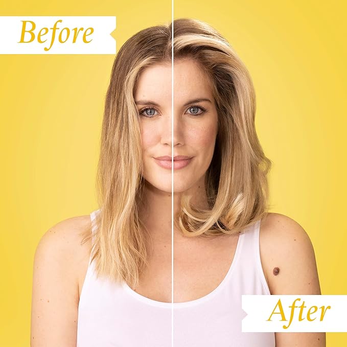 PHILIP KINGSLEY | Density Thickening Protein Spray | Volumizing Spray Treatment for Hair Loss and Fine, Fragile and Damaged Hair | 4.05oz