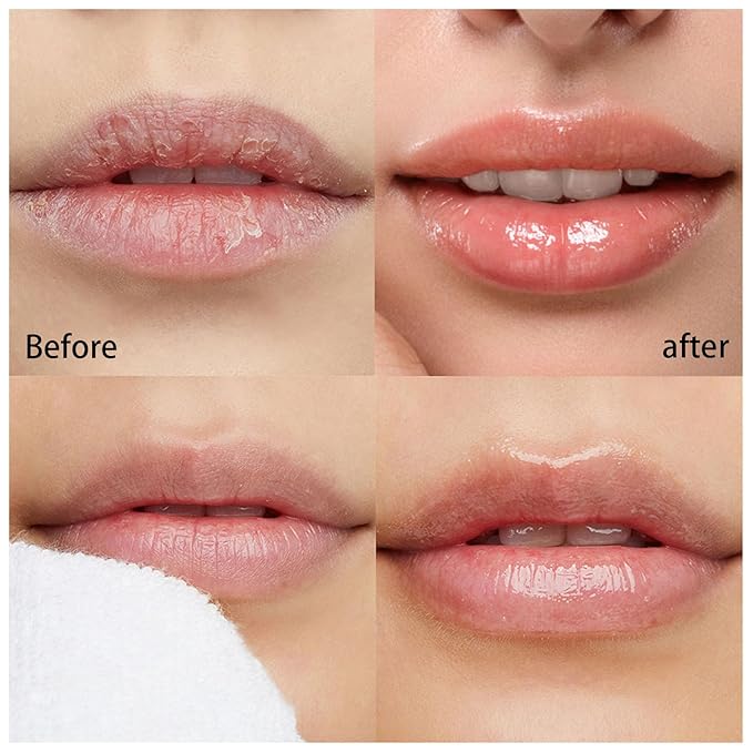 2 Pcs Lip Balm Honey Pot Lines