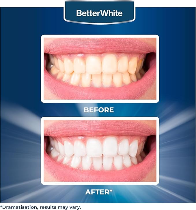 Teeth Whitening Powder - Hydroxyapatite, Remineralizing, Non-Sensitive Formula - Dentist-Approved Tooth Stain Remover & Polisher - Fluoride-Free - 6 Month Supply (40g)
