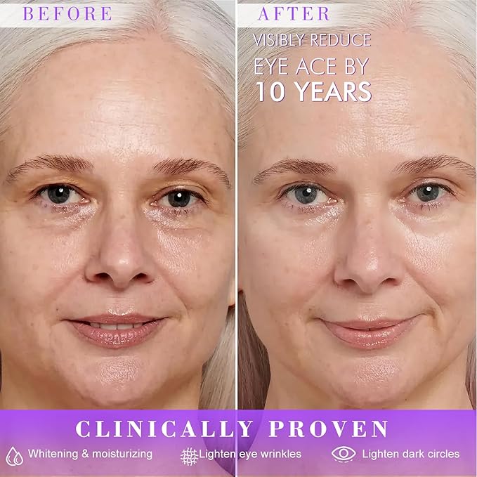 RIGBOO Eye Cream, Under Eye Cream Anti Aging For Puffiness Dark Circles Reduces, Wrinkle & Fine Line Reduction, Eliminate Puffiness, Ritch in 5% Niacinamide Acids for Brighter, Firmer Skin