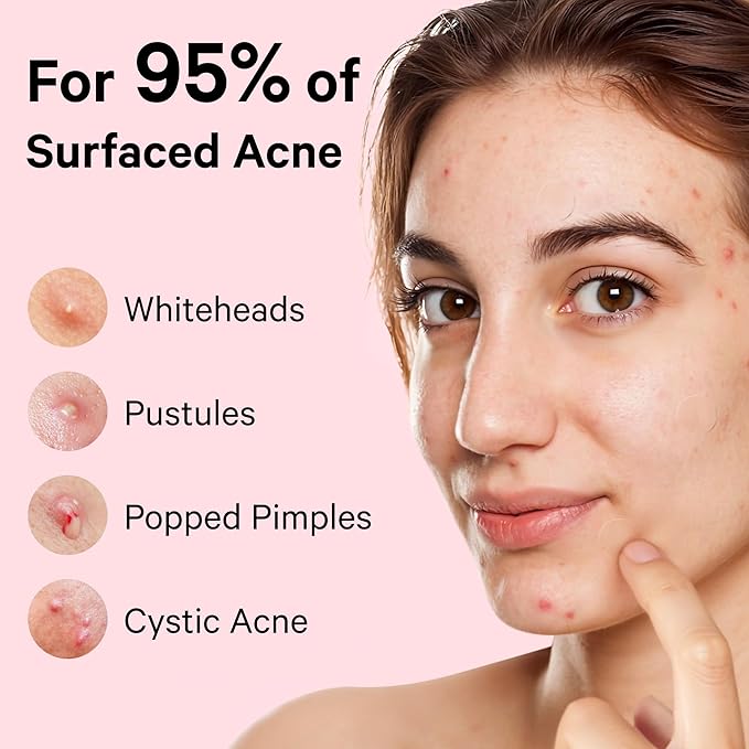 Sosky Pimple Patches for Face, Hydrocolloid Acne Patches with Salicylic Acid, Zit Stickers, Blemish Covers, 24 Count Invisible
