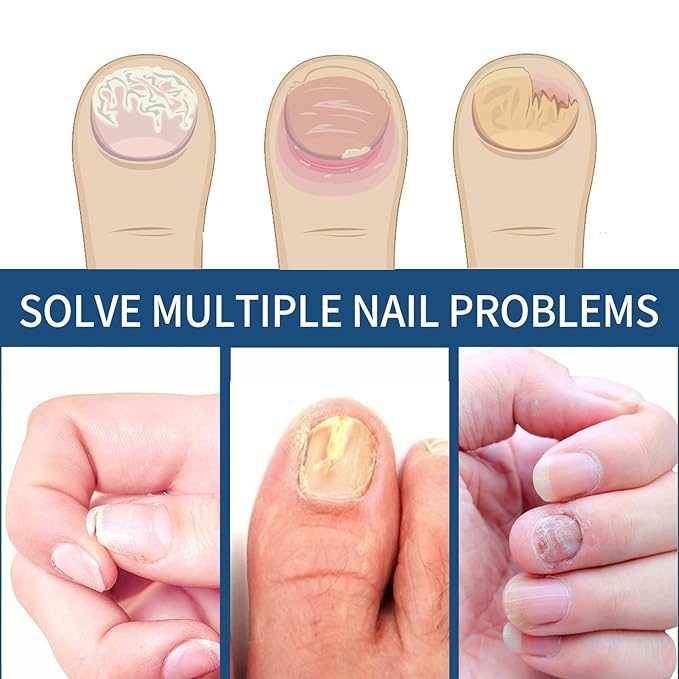 Nail Repair Patches 64 PCS,Nail