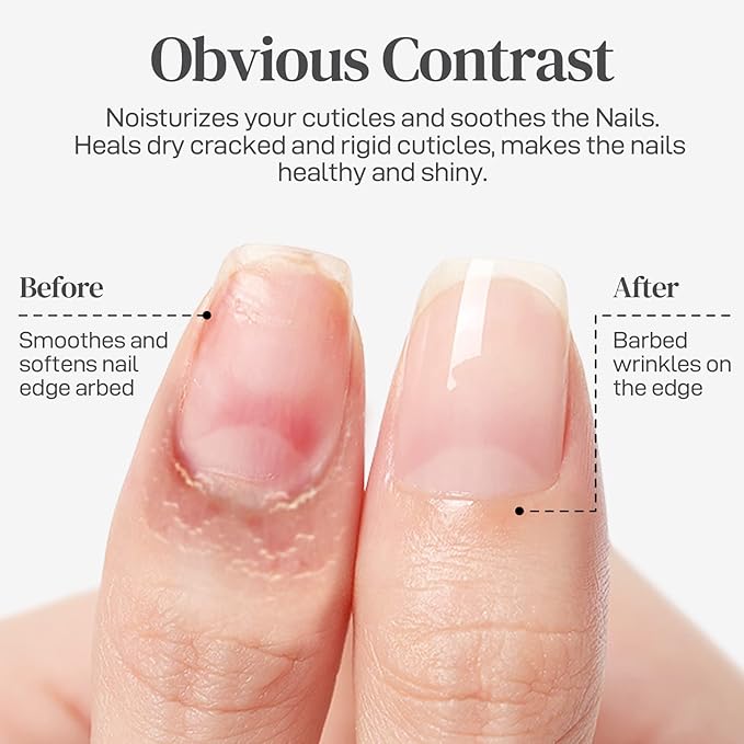 Nail Cuticle Oil for Nails
