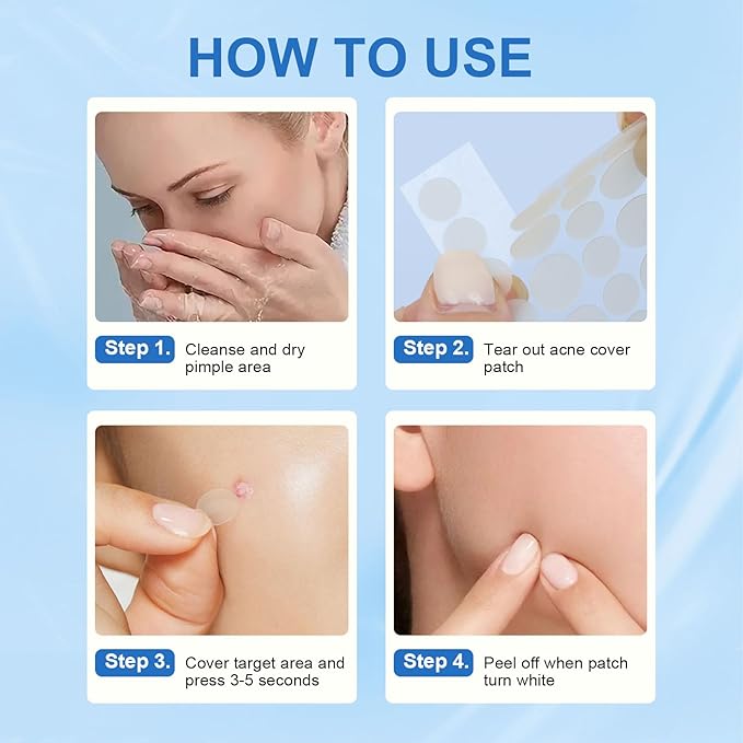 Amouy Acne Pimple Patch- 2 Sizes 432 Dots Thin & Thick Hydrocolloid Patches for Face with Witch Hazel, Tea Tree & Calendula Oil, Extra Adhesion Pimple Patches for Face Zit Patch Acne Dots