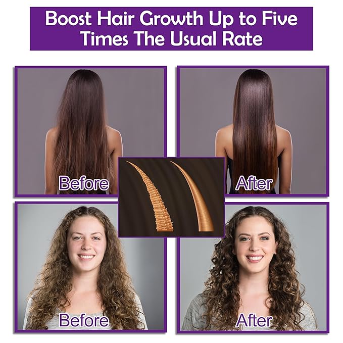 Hair Growth Shampoo and Conditioner Set With Rosemary, Biotin, Argan, and Castor Oils for Thinning, Damaged, Curly Hair
