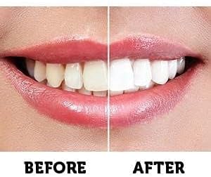 Active Wow 24k White Premium Teeth Whitening Kit - LED Light, Fluoride Free - Mint Flavor, 30 Treatments