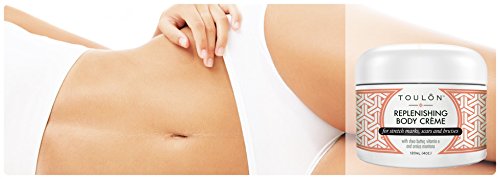 Bruise Cream with Arnica Montana, Shea