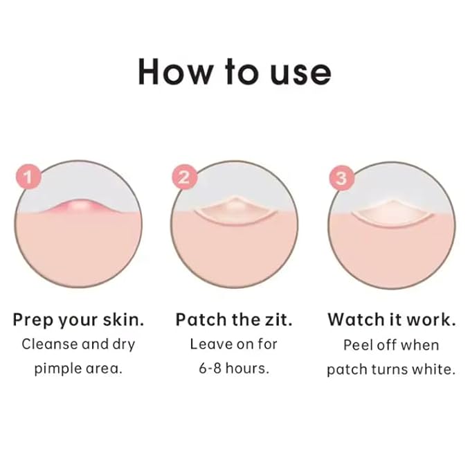 Hydrocolloid Acne Patch Stickers – Overnight Blemish & Cystic Acne Treatment with Tea Tree Oil | Invisible Skin Spot Care Patches (Pack size)
