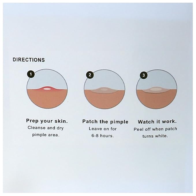 SDA LABORATORIES Magic Pimple Patch Invisible Hydrocolloid Acne Dots – Blemish & Clarifying Patches for Face & Body – Pore Cleansing Strips – 108 Count (Pack of 1)