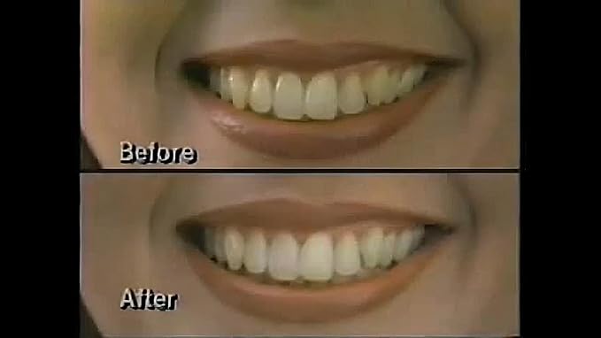 Dr. George's Dental White Whitening for Two by Dr. George's