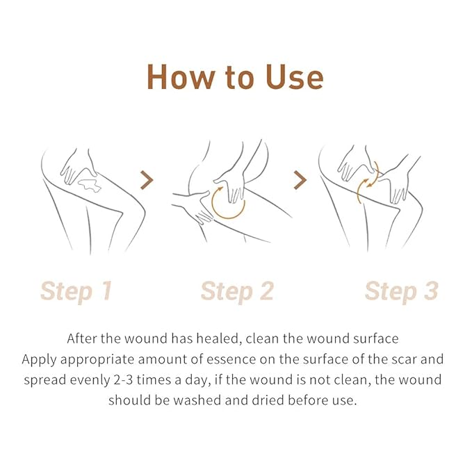 Acne Scar Removal Cream Stretch Marks (Packaging