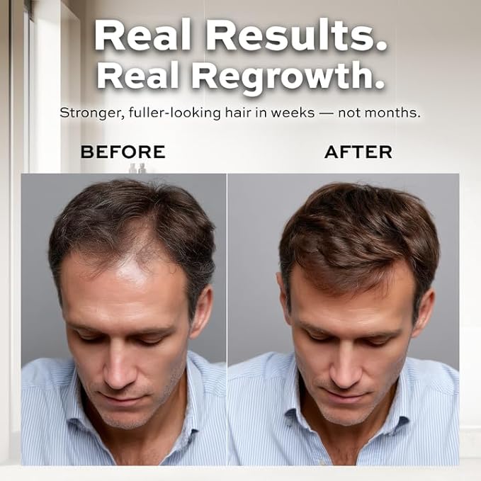 Reforian Castor Oil Shampoo and Conditioner for Hair Growth & Strength – 2 in 1 Shampoo and Conditioner Set for Men & Women – Sulfate-Free Formula for Thinning, Dry or Color-Treated Hair, 8oz