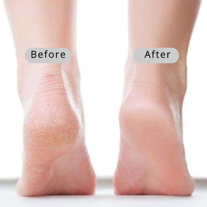 Straight Handle Pumice Stone - Professional Firm Control Foot Scrubber for Stubborn Calluses - Natural Dead Skin Remover & Pedicure File for Feet and Hands - 14“
