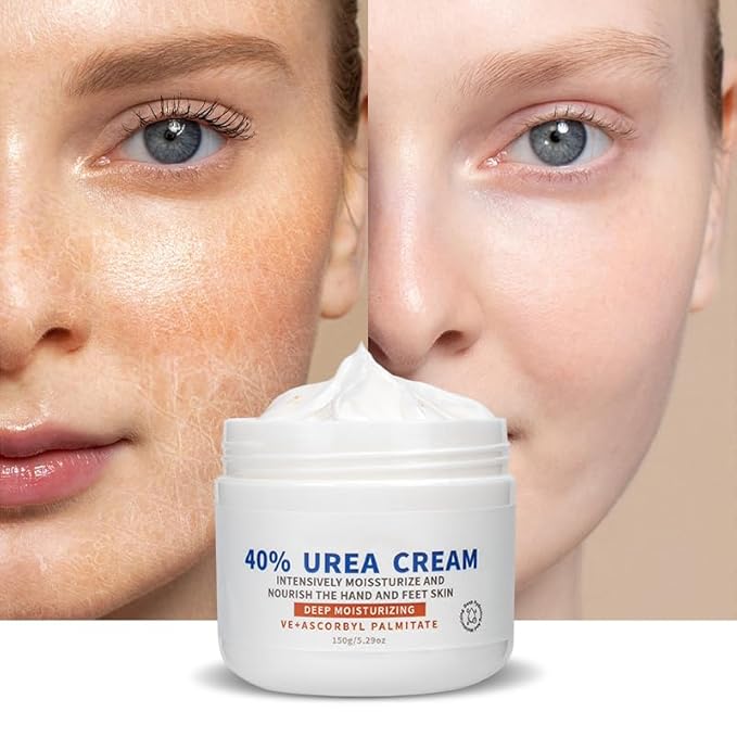 Urea Cream 40 Percent for Feet Maximum Strength, Moisturizes Foot Cream for Dry Cracked Heels and Feet Hand Knees Elbows Urea Cream for Feet Removes Calluses Dead Skin and Soften Toenails 5.29 Oz