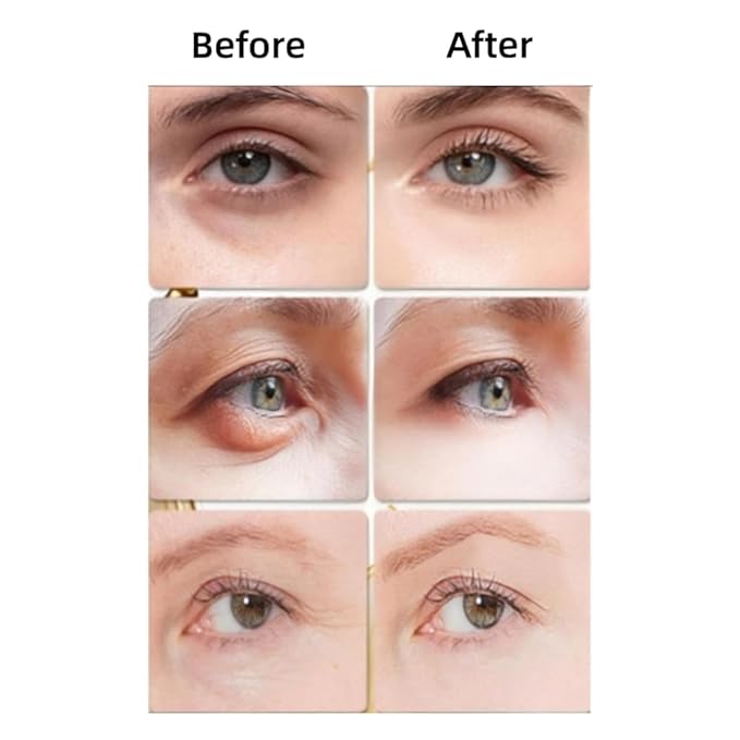 LESITI Snake Peptide Eye Cream with Massage Roller, Caffeine Reduce Eye Wrinkles Dark Circles, Anti-Aging Eye Cream for Dark Circles, Puffiness & Wrinkles, Hydrating