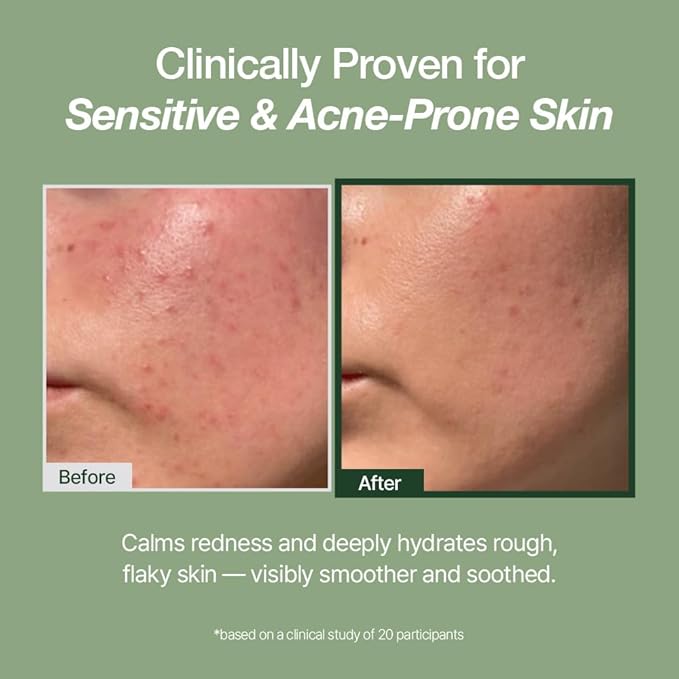 NATURAL DERMA PROJECT NDP Green Caper Milky Toner Essence - Hydrating Korean Toner for Face, Deep Moisture for Sensitive and Dry Skin, Panthenol, Madecassoside (4.39 Fl oz / 130ml)