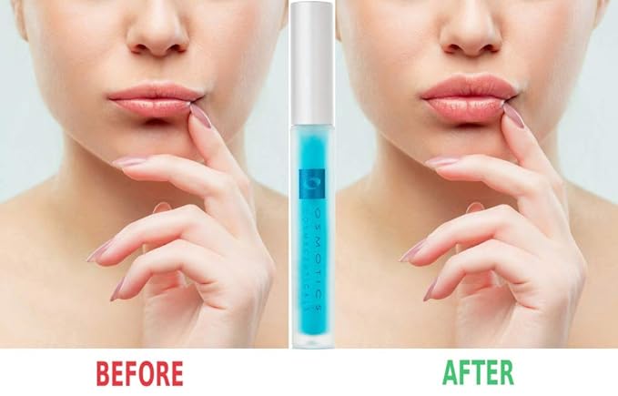 Osmotics Lip Plumper, Best Natural Lip Lips