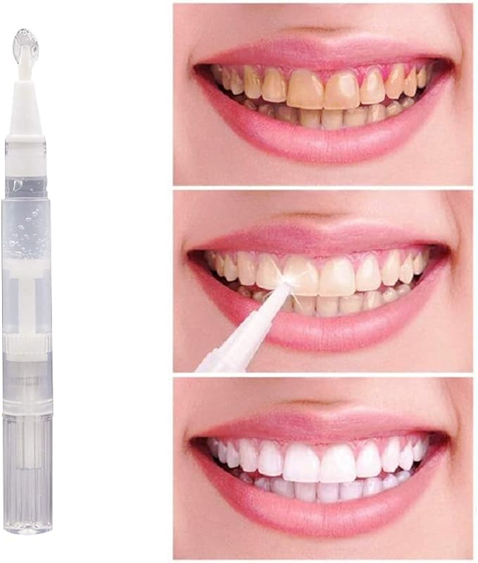 10 pcs Teeth Whitening Gel Pen 2ml Oral Cleaning Pen, Safe 44% Carbamide Peroxide Gel, 20+ Uses, Effective, Painless, No Sensitivity, Travel-Friendly, Natural Mint Flavor