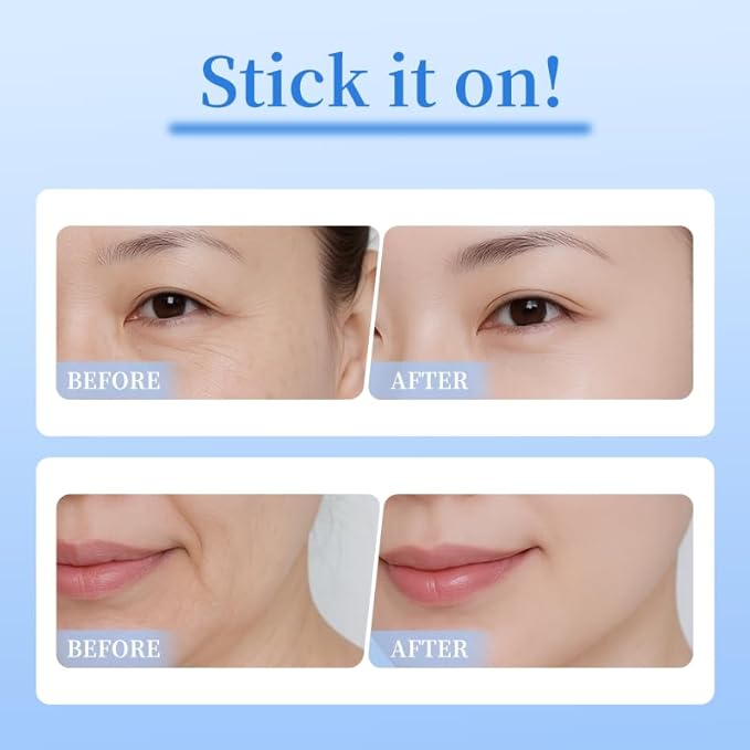 Natener 4 pairs PDRN Micro Eye Patches, Under Eye Patches for Puffy eyes, Dark Circles & Wrinkle | Hyaluronic Acid, Kojic Acid, Collagen, Peptides, Vitamin C, Niacinamide - Korean Popular Eye Care