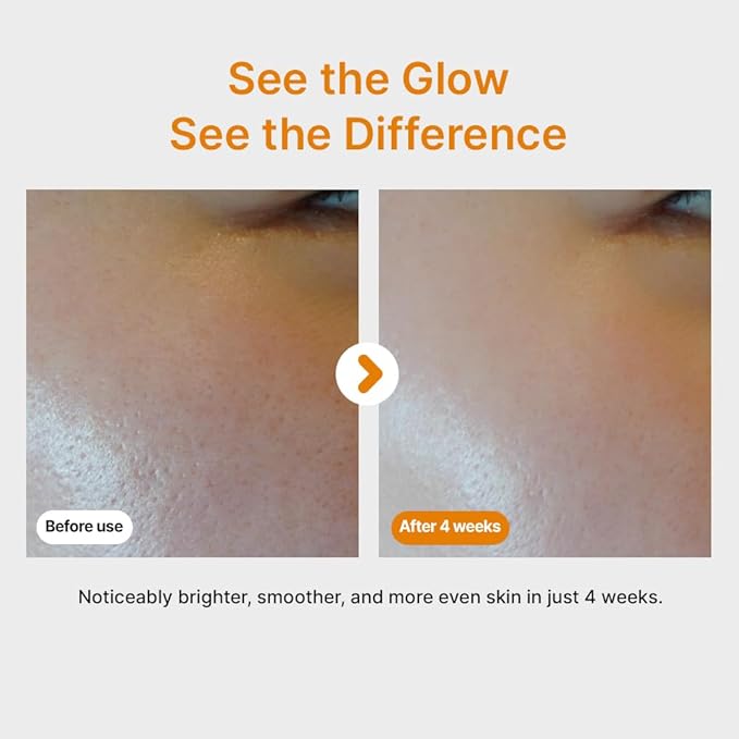SUMSAE Pure Vitamin C Serum - Best Korean Skincare with Vitamin 10.5%, No Added Water, Special Airless Pump, Brightening and Firming Skin, Improving Uneven and Dull Skin Tone, 30ml/1.01fl.oz.