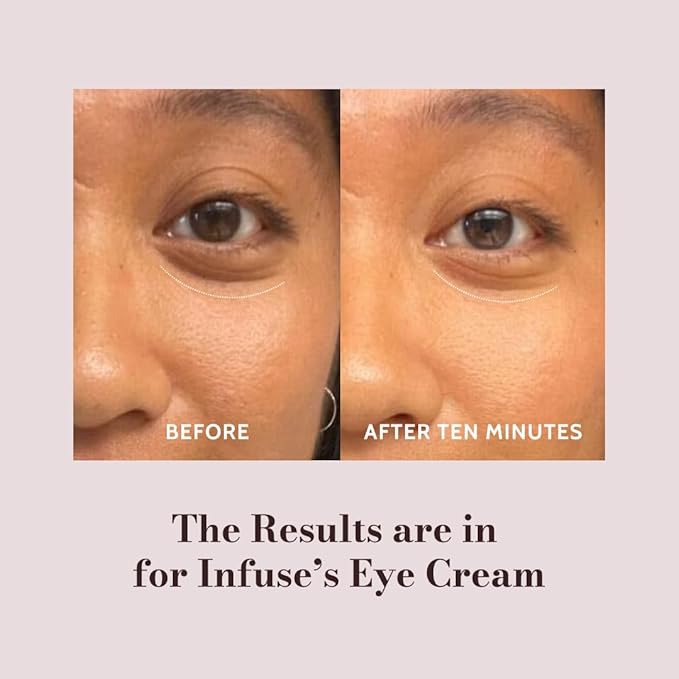 Infuse AWARD WINNER Peptide Eye Cream for Dark Circles, Puffiness & Fine Lines | Yerba Mate Fast-Acting Formula for Women in Their Prime