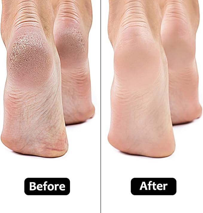 Upgrade Electronic Foot File Grinder