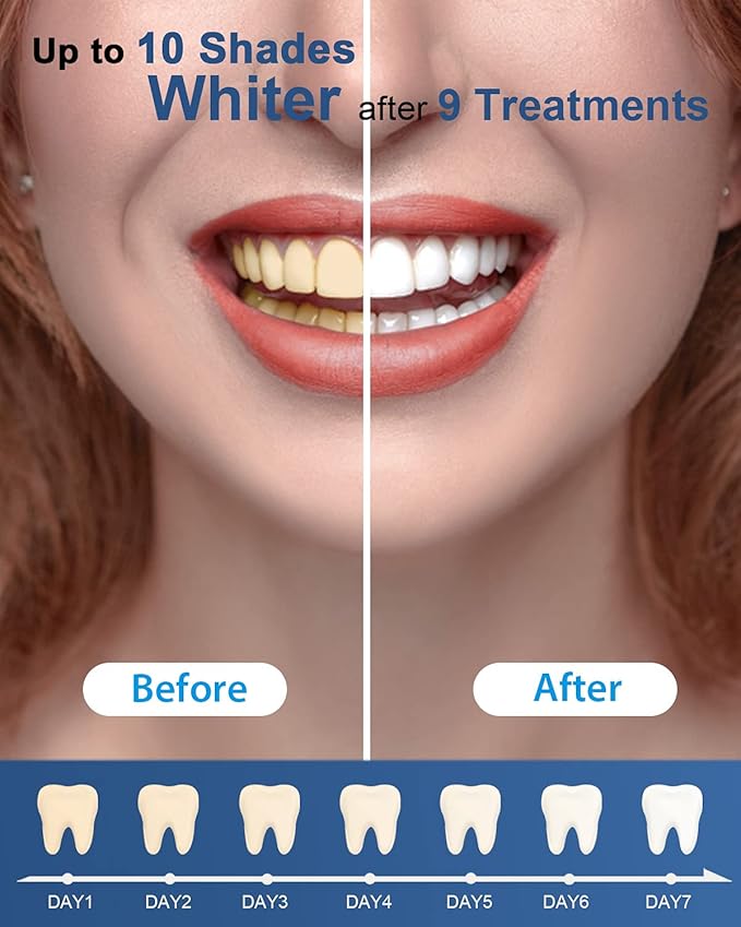 MySmile Teeth Whitening Gel Refills Pack, 6 Non-Sensitive Tooth Whitening Gel for White Teeth, Teeth Whitener Dental Grade Tooth Stain Remover for Tray, Fast Result Whitening
