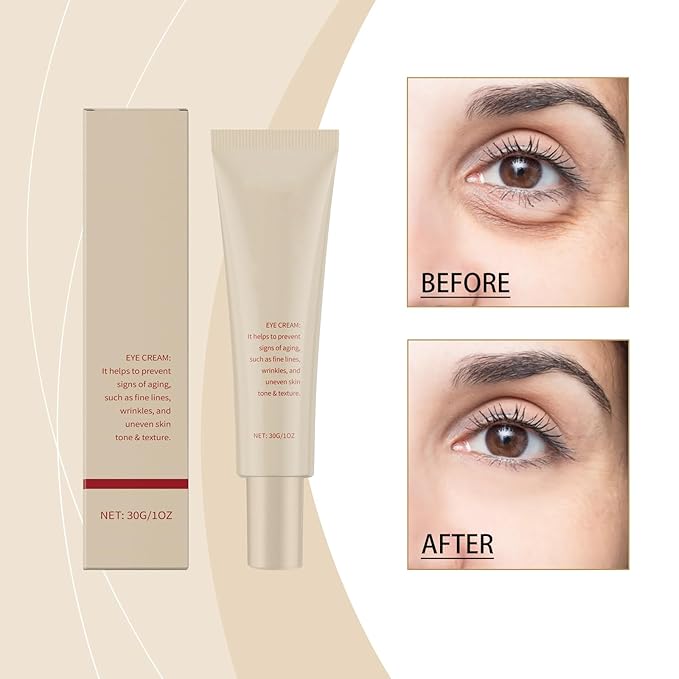 Retinol Anti-Wrinkle Eye Cream 30g - Visibly Diminishes Fine Lines & Wrinkles, Hydrates & Firms, Gentle Formula for All Skin Types, Daily Use, Cruelty-Free