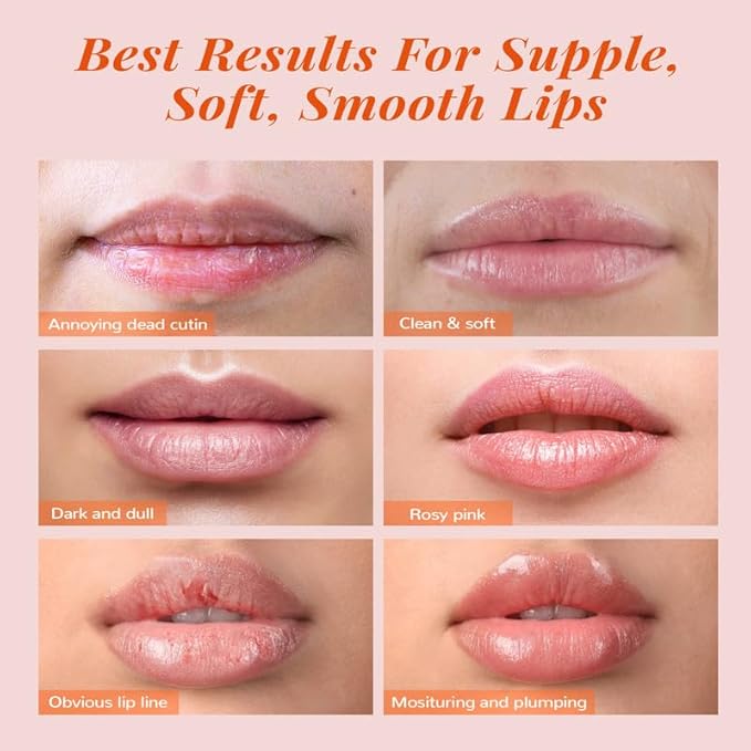 ANAIRUI Lip Mask Set, Lip Exfoliator Lips