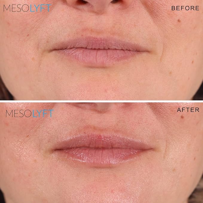 Neck & Lip Plumper Combo Plumping