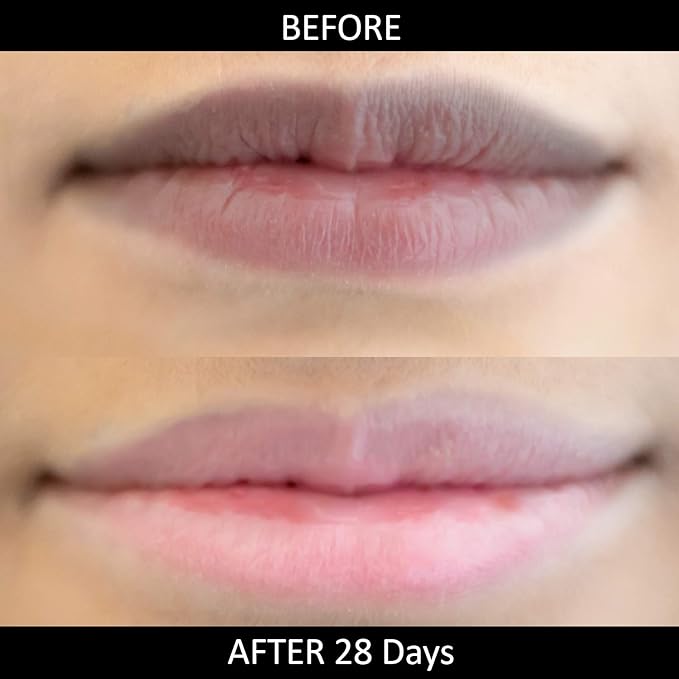 Omorfee 100% Organic Lip Lightening Balm,