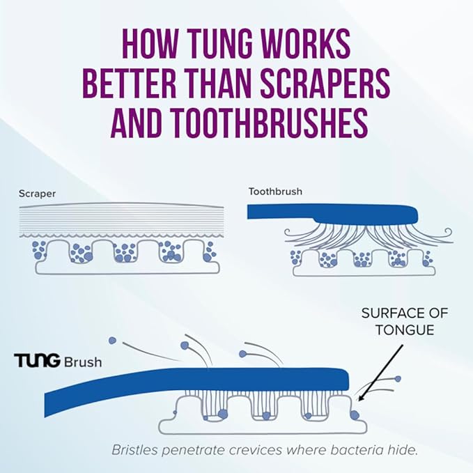 Tung Tongue Cleaning Kit, Tung Brush and Gel, Bad Breath Odor Eliminator, Halitosis Defense, USA Made (Set of 1)