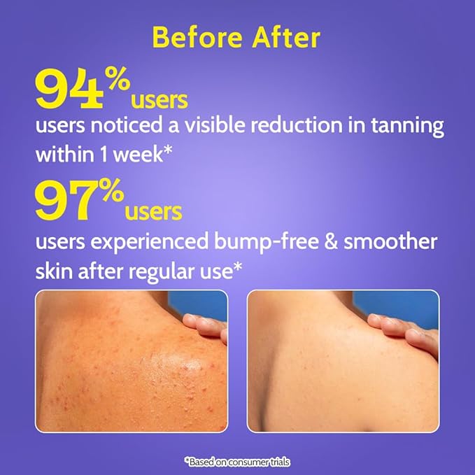Chemist at Play Body Wash Exfoliating For Dry Rough Bumpy Strawberry Skin With 1% Salicylic Acid 2% Lactic Acid And Ceramides For Men And Women 7.9 Fl oz
