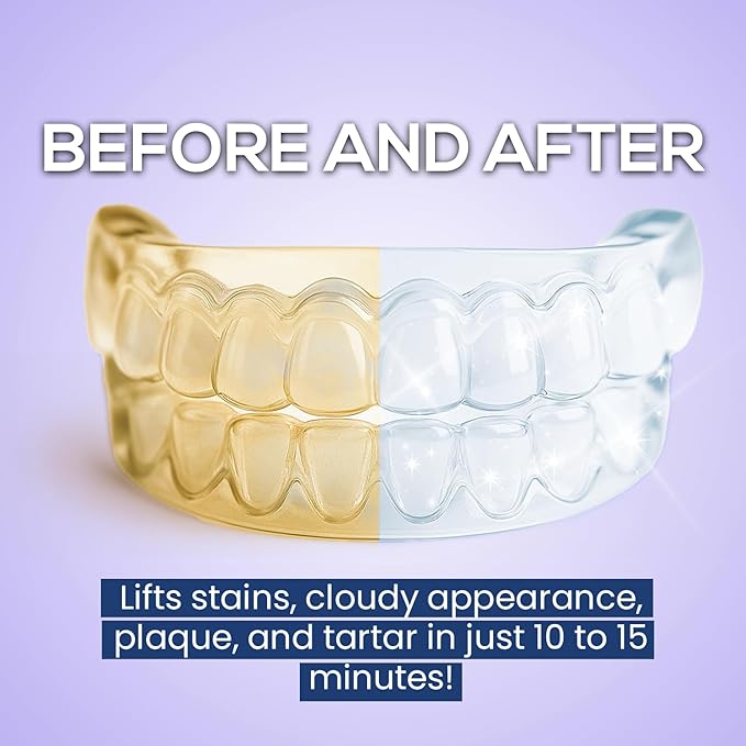 Venus Visage Retainer Cleaner Tablets, Dental Appliance and Denture Cleaning Tablets, Aligners and Night Mouth Guard Cleaner, 120 Pieces