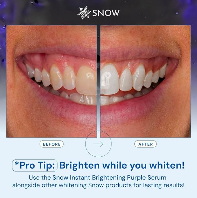 SNOW Teeth Brightening Purple Serum | Gentle & Enamel Safe Instant Brightening for Brighter Smile | Dental Care, Hygiene, & Tooth Care Bright Smile for Events Daily Confidence 2 Month Supply