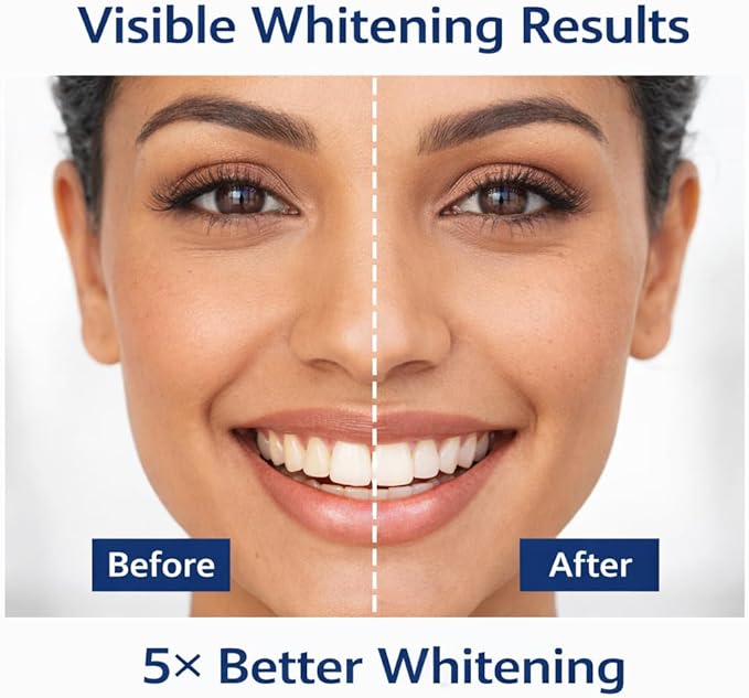 Teeth Whitening Strips, Mint Flavor Inspired, Comfort Fit Adhesive, Fresh Taste, 28 Strips in 14 Sealed Pouches, at Home Smile Brightening Routine