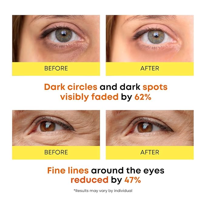 SOMISOME 360° Vitamin C Eye Masks – Korean Under Eye Patches for Puffy Eyes & Dark Circles, Lifting Eye Tone Up with Niacinamide & Bakuchiol, Hydrating and Soothing 50 Masks