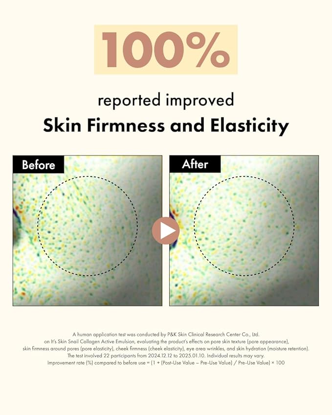 It'S SKIN Active Snail Collagen Cream 1.69 fl.oz, Firming Face Cream with Snail Mucin, Dual Collagen & Liposome for Elasticity, Long Lasting Moisture, Non-Greasy Moisturizing Cream, Korean Skincare
