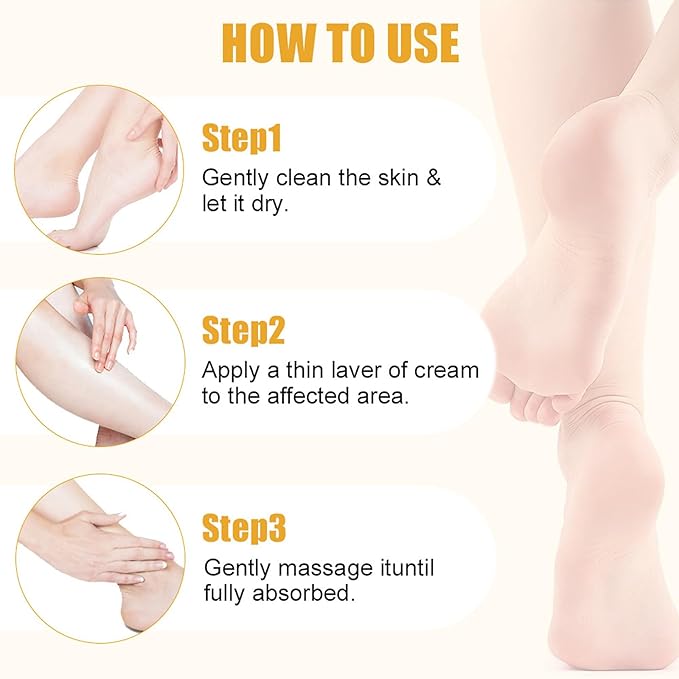 2pcs Urea Cream Stick 60% plus Salicylic Acid 2%, Maximum Strength Urea Foot Cream for Dry Cracked Heels, Feet Callus Remover, Hands Knees Exfoliating Dead Skin, Softening Skin Moisturizer Lotion