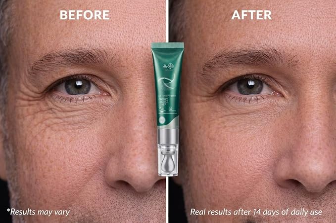 Lifting Power Eye Fluid - Rejuvenating Anti Aging Serum - Hydrating Eye Wrinkle Cream for Women with 5 Peptides & Vitamins - Ceramide, Hyaluronic Acid, Vitamin C, Palmitoyl Tripeptide-1-15ml