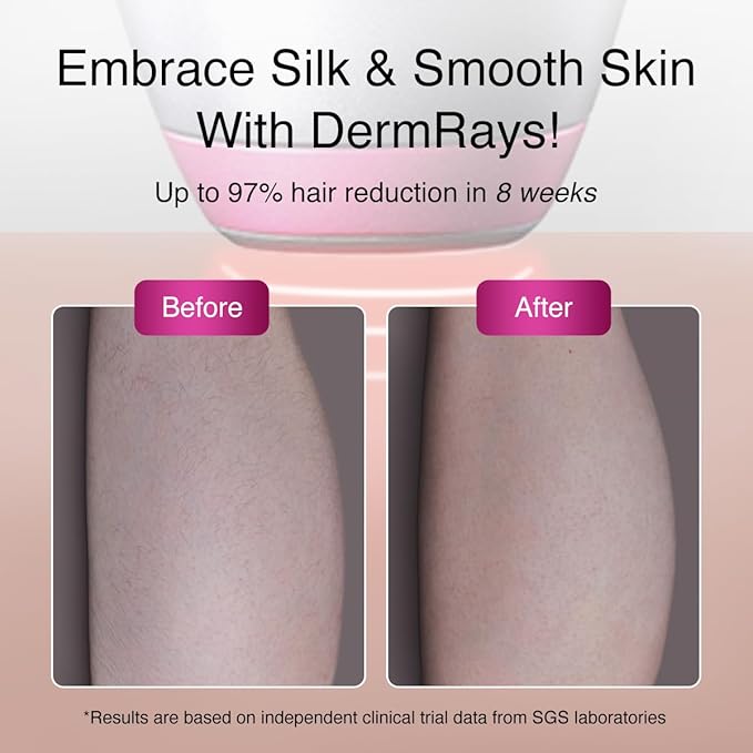 Upgrated Diode Laser Hair Removal for Dark Skin Tones, DermRays 1064nm Laser Hair Removal, Permanent Reduction in Hair Regrowth for Women and Men, V6S Suitable for Deep Skin Tone & Melanated Skin Tone