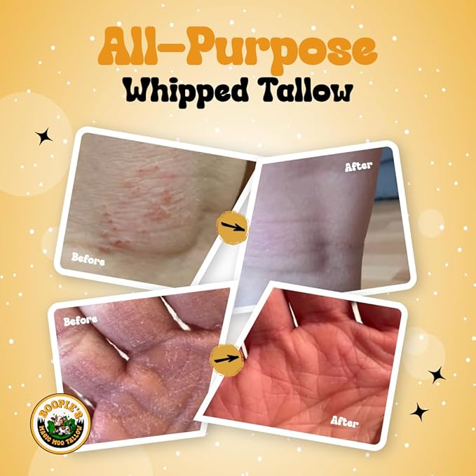 Magic Moo All Purpose Whipped Tallow Skincare for acne, eczema, dry skin, moisturizer, stretch marks & hydration. Now with organic emu oil. All organic ingredients.