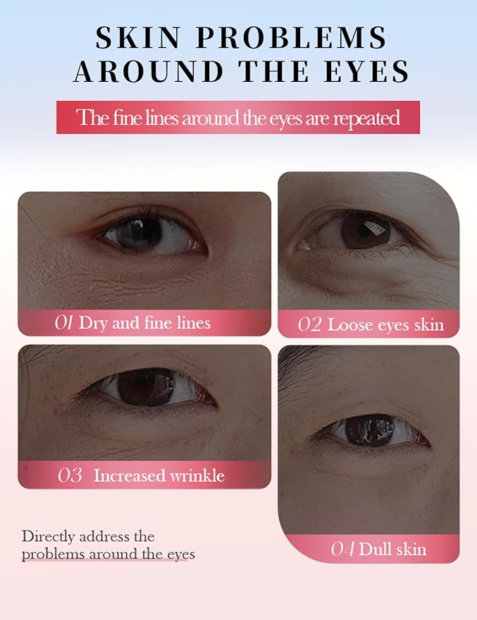 NORNI LEORD Under Eye Patches for Dark Circles - 80 PCS Eye Mask with Niacinamide, Collagen & Natural Extracts to Reduce Bags, Wrinkles, Fine Lines & Puffiness for Firmer, Elastic, Glowing Skin.